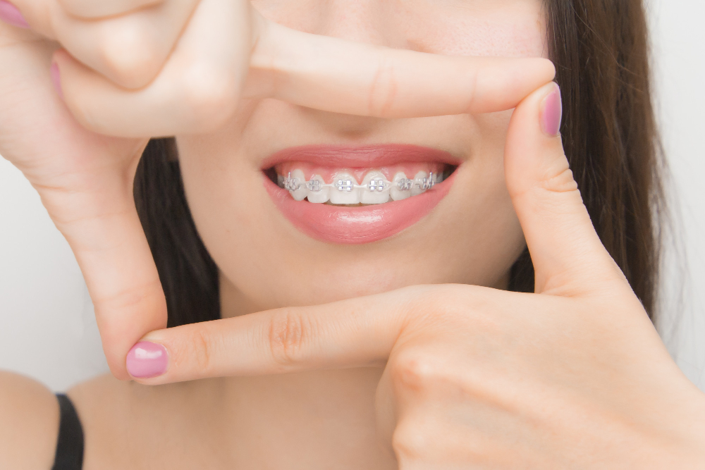 woman connecting her fingers to form a rectangle. she has braces and is smiling